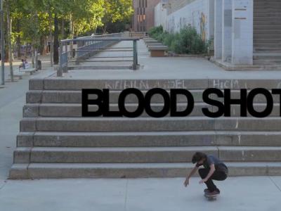 Trevor McClung最新Plan B滑板大片「Blood Shot」发布